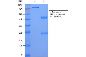 SDS-PAGE Analysis Serum Amyloid A Rabbit Recombinant Monoclonal Antibody (SAA/2868R). (Recombinant SAA 抗体)