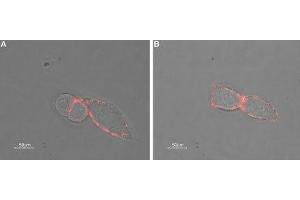 Immunocytochemistry (ICC) image for anti-gamma-aminobutyric Acid (GABA) A Receptor, alpha 3 (GABRA3) (AA 29-43), (Extracellular) antibody (ABIN7043187)
