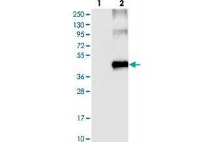 Western blot analysis of Lane 1: Negative control (vector only transfected HEK293T lysate). (SLC16A7 抗体)