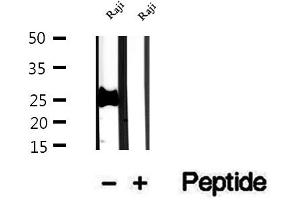 Western blot analysis of extracts of Raji cells, using PCMT1 antibody. (PCMT1 抗体  (Internal Region))