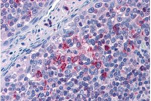 Immunohistochemistry (IHC) image for anti-Arachidonate 5-Lipoxygenase-Activating Protein (ALOX5AP) (C-Term) antibody (ABIN185249)