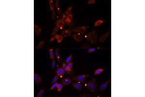 Immunofluorescence (IF) image for anti-Inhibitor of kappa Light Polypeptide Gene Enhancer in B-Cells, Kinase epsilon (IKBKE) (AA 495-716) antibody (ABIN3020771)
