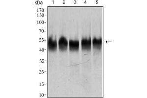 Western Blotting (WB) image for anti-Tubulin, beta 2A (TUBB2A) (AA 25-187) antibody (ABIN1846607) (TUBB2A 抗体  (AA 25-187))