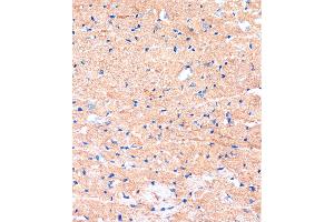 Immunohistochemistry of paraffin-embedded Mouse heart using ME3 Rabbit pAb (ABIN7268384) at dilution of 1:100 (40x lens). (ME3 抗体  (AA 505-604))