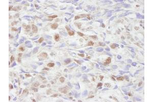 anti-Nuclear Receptor Coactivator 2 (NCOA2) (C-Term) antibody