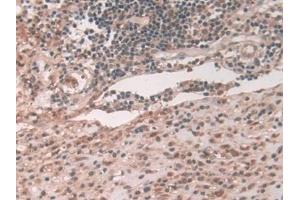 Detection of ATP7b in Human Appendix Tissue using Polyclonal Antibody to ATPase, Cu++ Transporting Beta Polypeptide (ATP7b)