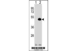 Western blot analysis of ASS1 using rabbit polyclonal ASS1 Antibody using 293 cell lysates (2 ug/lane) either nontransfected (Lane 1) or transiently transfected (Lane 2) with the ASS1 gene. (ASS1 抗体  (C-Term))