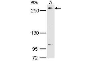 WB Image Sample (30 ug of whole cell lysate) A: 293T 5% SDS PAGE antibody diluted at 1:2000 (POLR2A/RPB1 抗体  (C-Term))