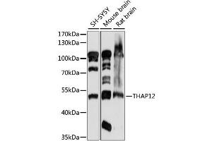 Western blot analysis of extracts of various cell lines, using THAP12 antibody (ABIN6292038) at 1:1000 dilution.