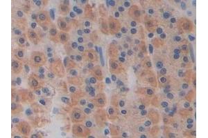 Immunohistochemistry (IHC) image for anti-Proteasome (Prosome, Macropain) Subunit, beta Type, 8 (Large Multifunctional Peptidase 7) (PSMB8) (AA 80-261) antibody (ABIN7440281)