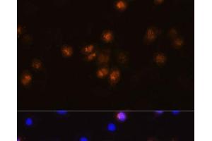 Immunofluorescence analysis of L929 cells using SWAP70 Polyclonal Antibody at dilution of 1:100. (SWAP70 抗体)