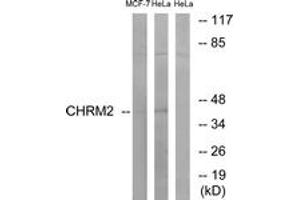 Western blot analysis of extracts from HeLa/MCF-7 cells, using CHRM2 Antibody. (Muscarinic Acetylcholine Receptor M2 抗体  (AA 185-234))