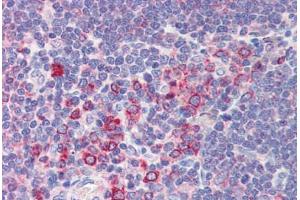 Immunohistochemistry (Paraffin-embedded Sections) (IHC (p)) image for anti-B-Cell CLL/lymphoma 11A (Zinc Finger Protein) (BCL11A) (N-Term) antibody (ABIN6741578)