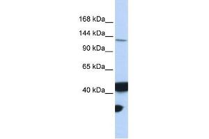 MLH3 antibody used at 1 ug/ml to detect target protein. (MLH3 抗体)