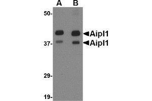 Western Blotting (WB) image for anti-Aryl Hydrocarbon Receptor Interacting Protein-Like 1 (AIPL1) (Middle Region) antibody (ABIN1030848)