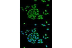 Immunofluorescence analysis of HeLa cells using PICK1 antibody. (PICK1 抗体)