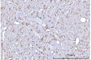 IHC analysis of RAP1GAP using anti-RAP1GAP antibody (ABIN7599729). (RAP1GAP 抗体  (AA 11-661))