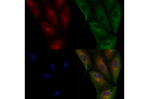 ABIN6265844 and ABIN6276978 staining  cells by IF/ICC. (UBE2D1 抗体  (C-Term))