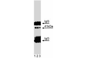 Western blot analysis of Doublecortin on a mouse neonate lysate. (Doublecortin 抗体  (AA 211-317))