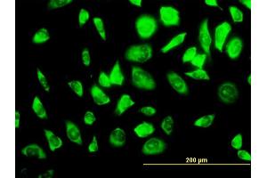 Immunofluorescence of monoclonal antibody to RPS23 on HeLa cell.