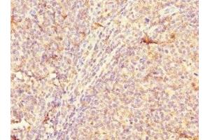 Immunohistochemistry of paraffin-embedded human tonsil tissue using ABIN7147978 at dilution of 1:100 (CD3A (AA 18-180) 抗体)