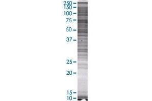 Western Blotting (WB) image for SYK 293T Cell Transient Overexpression Lysate(Denatured) (ABIN1333634)