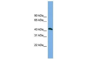 ANKMY2 antibody used at 1 ug/ml to detect target protein. (ANKMY2 抗体  (N-Term))