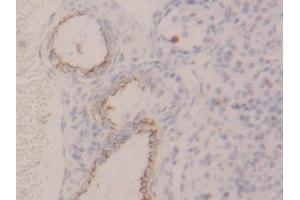 DAB staining on IHC-P; Samples: Rat Ovary Tissue (KRT4 抗体  (AA 317-454))