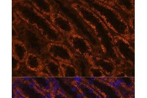 Immunofluorescence analysis of Rat kidney using LAMC2 Polyclonal Antibody at dilution of 1:100 (40x lens). (LAMC2 抗体)