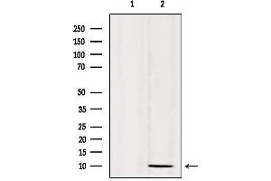 Western blot analysis of extracts from 293, using SPINK1 Antibody. (SPINK1 抗体  (Internal Region))
