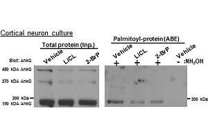 Lysates of rat cortical neurons treated with the indicated compounds were subjected to ABE to purify palmitoylated proteins.