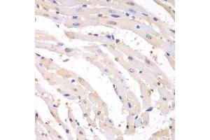 Immunohistochemistry (Paraffin-embedded Sections) (IHC (p)) image for anti-Proteasome (Prosome, Macropain) Subunit, beta Type, 1 (PSMB1) (AA 29-241) antibody (ABIN6146309)