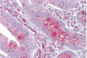 Immunohistochemistry with Small intestine tissue at an antibody concentration of 5µg/ml using anti-OAS1 antibody (ARP51359_P050) (OAS1 抗体  (Middle Region))