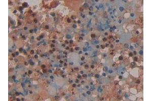 Immunohistochemistry (IHC) image for anti-Proteinase 3 (PRTN3) (AA 71-247) antibody (ABIN7433627)