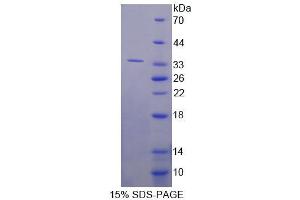 SDS-PAGE analysis of Human RSU1 Protein. (RSU1 蛋白)