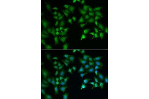 Immunofluorescence analysis of A549 cells using FLOT2 antibody (ABIN5973960). (Flotillin 2 抗体)