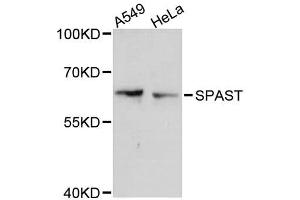 Western blot analysis of extracts of various cell lines, using SPAST antibody (ABIN5996162) at 1:3000 dilution. (Spastin 抗体)