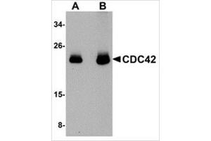 Western blot analysis of CDC42 in human brain tissue lysate with CDC42 antibody at (A) 0. (CDC42 抗体  (N-Term))