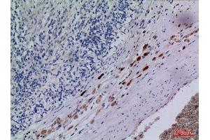 Immunohistochemistry (IHC) image for anti-Chemokine (C-X-C Motif) Receptor 3 (CXCR3) (Internal Region) antibody (ABIN6281636)