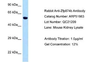 WB Suggested Anti-Zfp874b Antibody   Titration: 1.