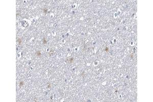 Immunohistochemistry (IHC) image for anti-Protein Phosphatase 1, Regulatory (Inhibitor) Subunit 14A (PPP1R14A) (pThr38) antibody (ABIN6256551)