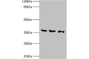 Western blot All lanes: N-acetyl-D-glucosamine kinase antibody at 2 μg/mL Lane 1: HepG2 whole cell lysate Lane 2: 293T whole cell lysate Lane 3: Hela whole cell lysate Secondary Goat polyclonal to rabbit IgG at 1/10000 dilution Predicted band size: 38, 43 kDa Observed band size: 38 kDa (NAGK 抗体  (AA 2-344))