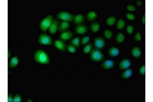 Immunofluorescent analysis of A549 cells using ABIN7156211 at dilution of 1:100 and Alexa Fluor 488-congugated AffiniPure Goat Anti-Rabbit IgG(H+L) (IDO2 抗体  (AA 1-407))