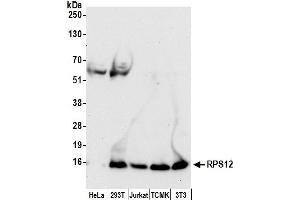 Western Blotting (WB) image for anti-Ribosomal Protein S12 (RPS12) (AA 25-75) antibody (ABIN7453198)
