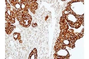 IHC-P Image Immunohistochemical analysis of paraffin-embedded N87 xenograft, using RAP2C, antibody at 1:100 dilution. (RAP2C 抗体)