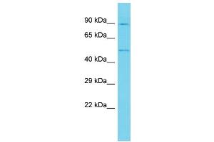 Host: Rabbit Target Name: ANKRD10 Sample Type: U937 Whole Cell lysates Antibody Dilution: 1. (ANKRD10 抗体  (C-Term))