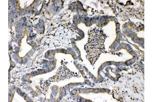 IHC analysis of Beta 2 Microglobulin using anti- Beta 2 Microglobulin antibody (ABIN5518810).