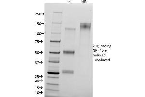SDS-PAGE Analysis of Purified CTNND1 Mouse Monoclonal Antibody (25a). (CTNND1 抗体)