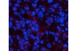 Immunofluorescence analysis of Mouse spleen tissue using PPARD Monoclonal Antibody at dilution of 1:200. (PPARD 抗体)