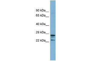 WB Suggested Anti-CUTC  Antibody Titration: 0. (CUTC 抗体  (Middle Region))